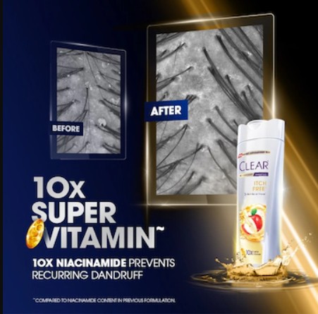 CLEAR ITCH FREE ANTI-DANDRUFF SHAMPOO 300ML